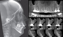 Tomografia computadorizada Cone-Beam para Endodontia / Periodontia / Ortodontia