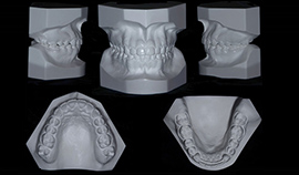 Modelos das arcadas dentárias