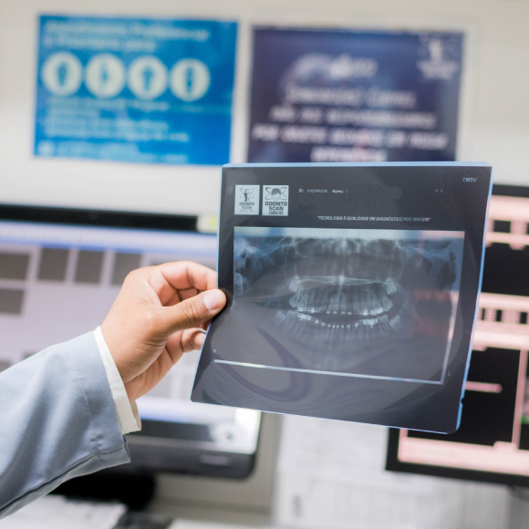 Tomografia ou radiografia para a avaliação de terceiros molares inferiores?