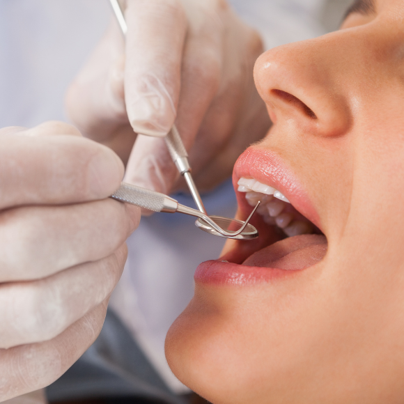 5 sinais que você precisa visitar o dentista