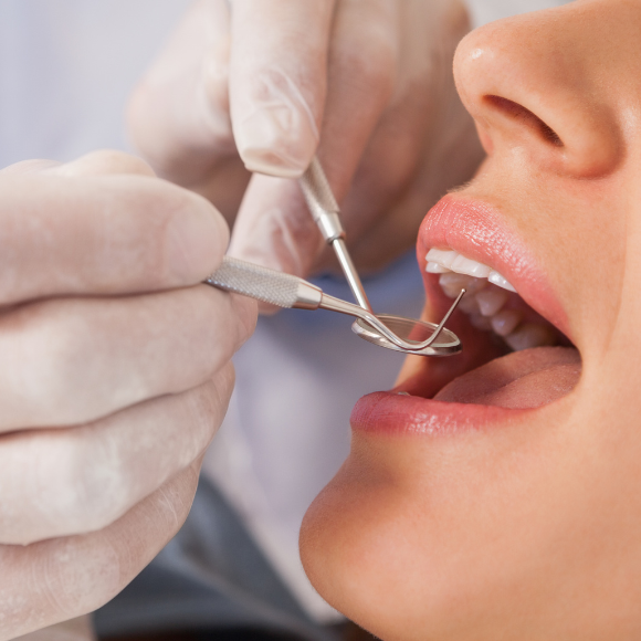 5 sinais de que você precisa ir ao dentista