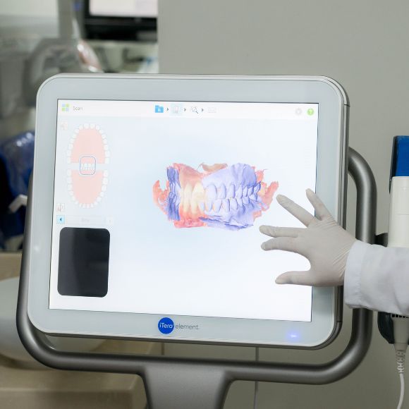 O digital revoluciona exames trazendo mais precisão 